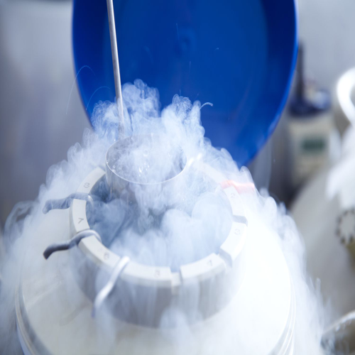 Oocyte/Sperm freezing