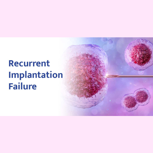 Recurrent Implantation Failure