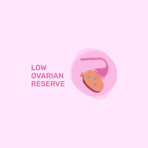 Reduced Ovarian Reserve