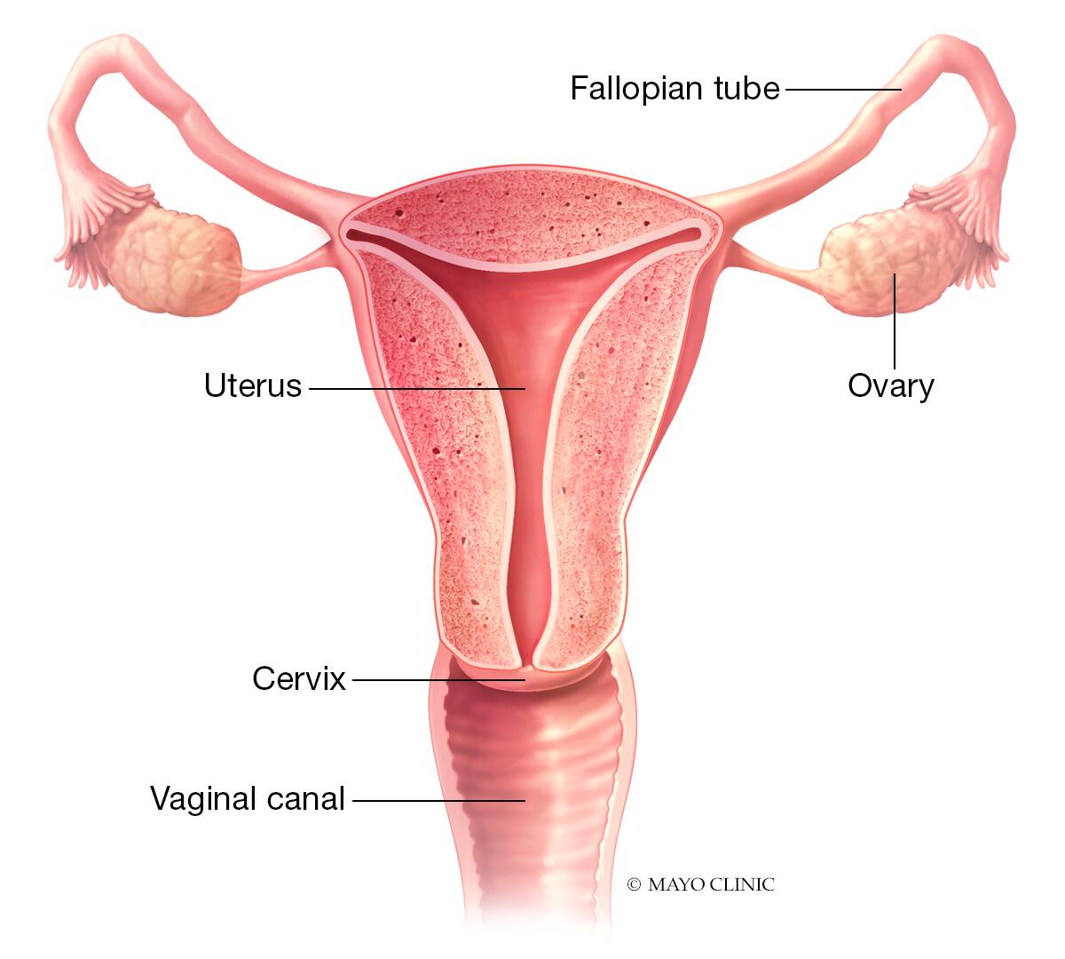 Complete Female Infertility